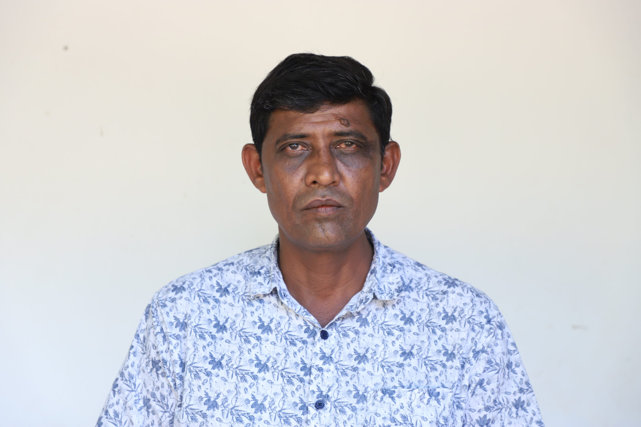Dimbulagala Water Project Image 1